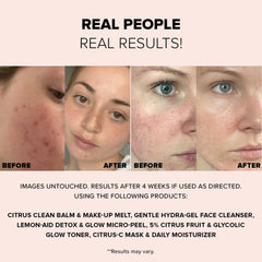 Easy Ultimate Glow Face Set
